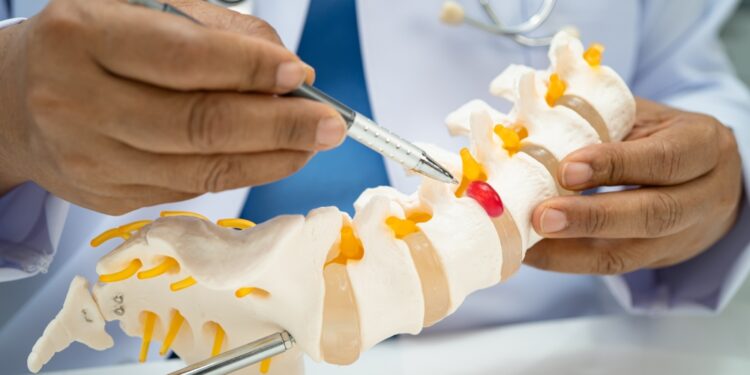 Juosmens stuburo dalies kompiuterinė tomografija (KT)