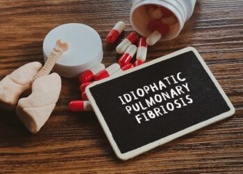 6 paslėpti IPF įspėjamieji požymiai