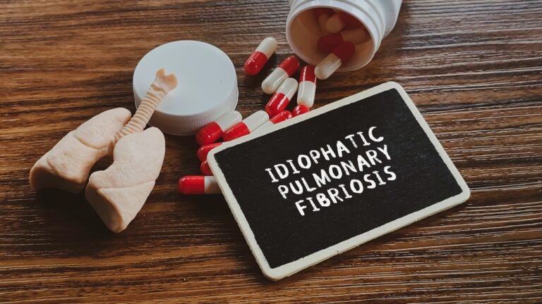 6 paslėpti IPF įspėjamieji požymiai