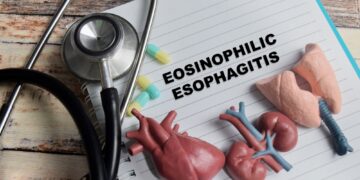 **Stemplės manometrija**