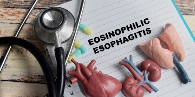 **Stemplės manometrija**