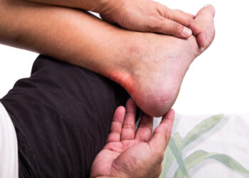 Ar podagra gali pasireikšti kulne?