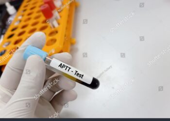 **Aktyvuoto dalinio tromboplastino laiko (ADTL, PTT) tyrimas**