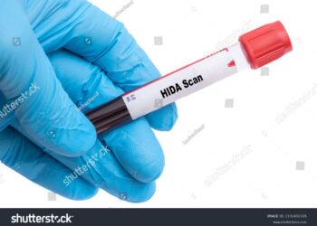 Kas yra HIDA tyrimas?