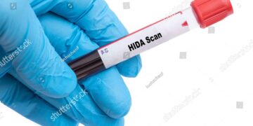Kas yra HIDA tyrimas?