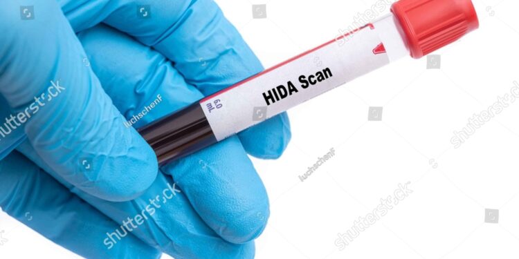 Kas yra HIDA tyrimas?