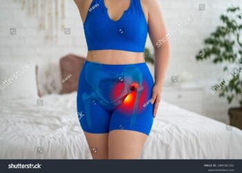 **Jūsų gidas apie IBD sukeltą displaziją**