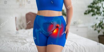 **Jūsų gidas apie IBD sukeltą displaziją**