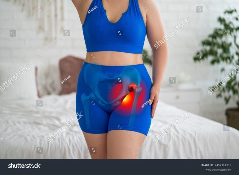 Jūsų gidas apie IBD sukeltą displaziją