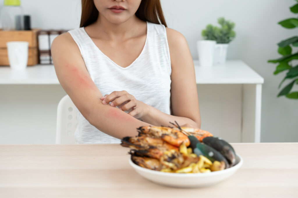 3 psoriazės sukėlėjai, apie kuriuos nežinojau, kad jie egzistuoja