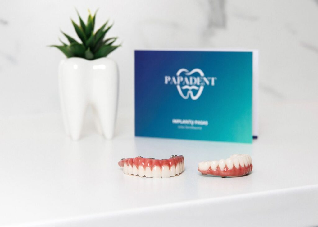 Dantų implantų ilgaamžiškumas ir priežiūra: 3 pagrindiniai pavojaus signalai pacientams