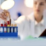 Kraujo tyrimai reumatoidiniam artritui nustatyti
