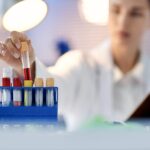 Padidėjęs feritinas ne visada reiškia geležies perteklių