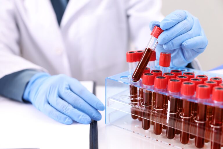 Pirštinėta ranka laiko kraujo mėgintuvėlį laboratorijoje