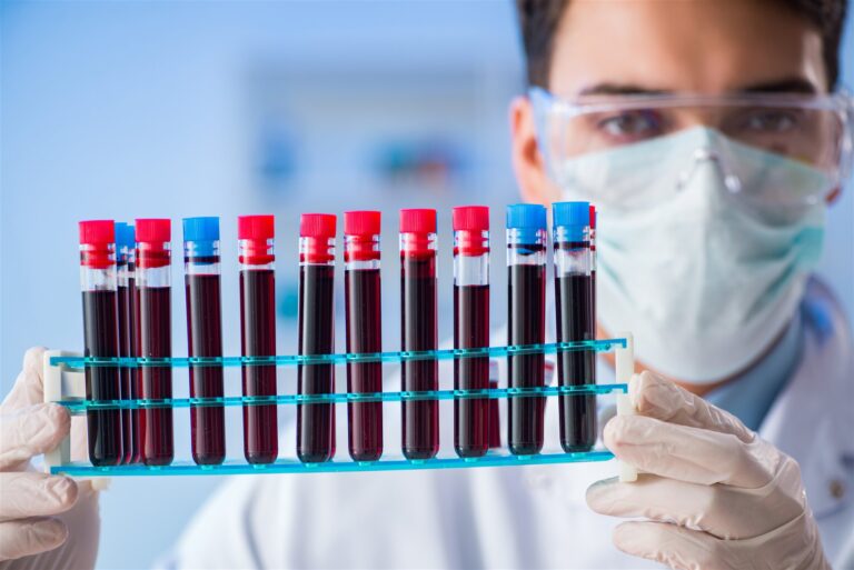 Laboratorijos darbuotojas tiria kraujo mėginius